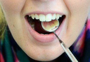 Zahnarztuntersuchung. Foto: Judith Wedderwille/Kreis Soest Kleiner Spiegel in einem Mund zum Untersuchen. Foto: Judith Wedderwille/Kreis Soest