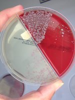 Positiver MRSA- Nachweis auf einer zweigeteilten Blutagar- und Selektivplatte. Foto: Alena Mönke